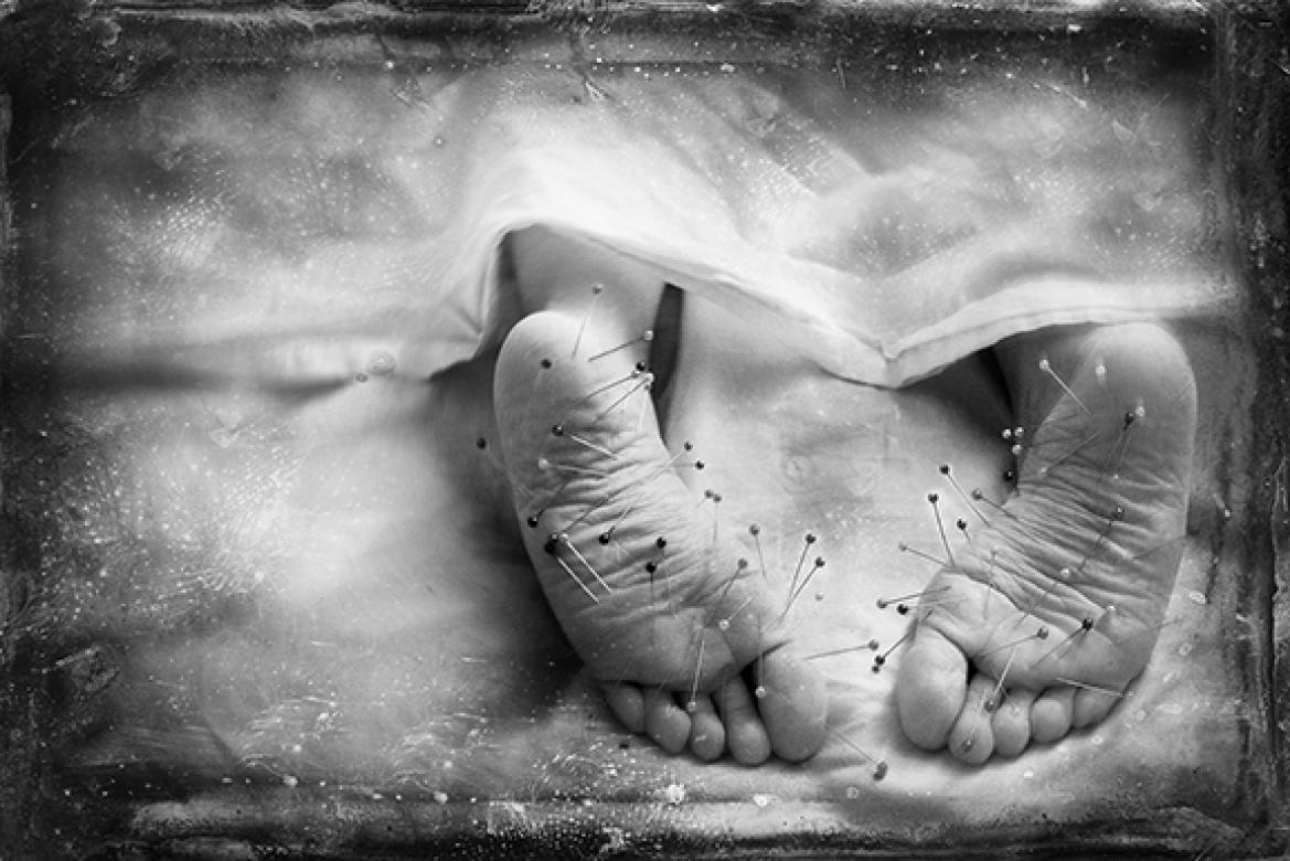 black and white photo of barefeet with pins in them under bed sheets 