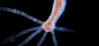 Hydras - microscope image that looks like a vein with tenticles. 