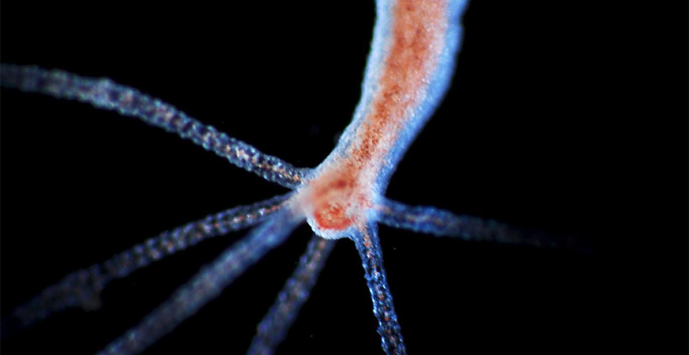 Hydras - microscope image that looks like a vein with tenticles. 